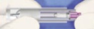 Osadzenie implantu Tapered Screw-Vent
