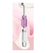 Osadzenie implantu Tapered Screw-Vent