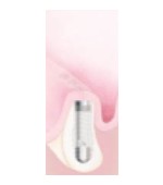 Osadzenie implantu Tapered Screw-Vent