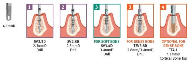 Implant 4,1mm (platforma 3,5mm) 